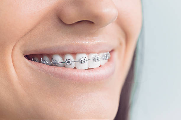 Reliable Montclair State University, NJ Dental Services Solutions